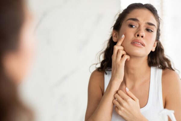 Acnee la adult: ce rol pot avea hormonii și produsele cosmetice